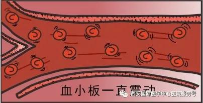 血小板是正常值的三倍？專家提醒小心血栓和出血！