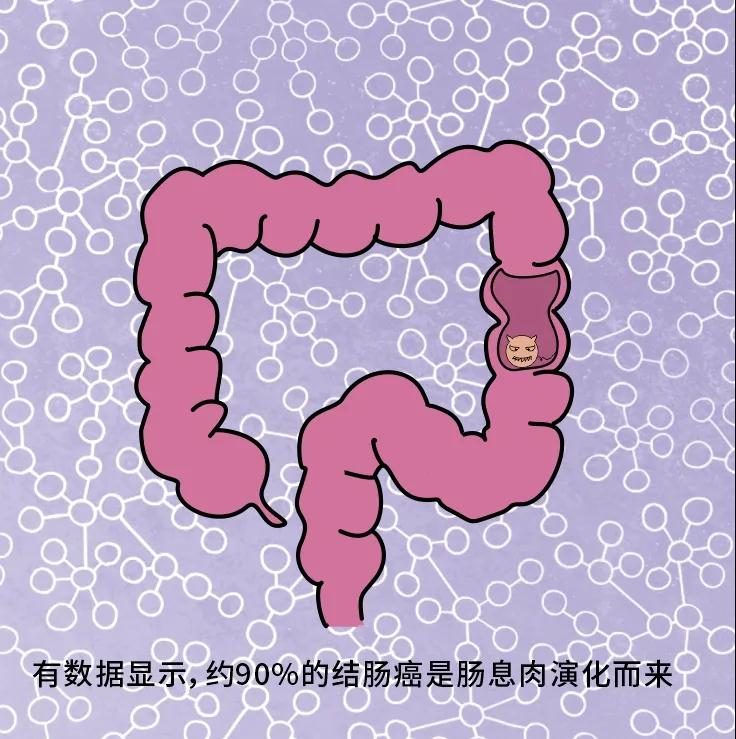 奪走“黑豹”生命的結(jié)腸癌，到底什么來頭？