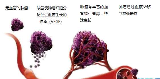 晚期腫瘤為什么會復發(fā)轉移？