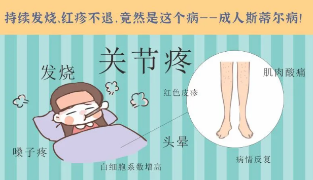 持續(xù)發(fā)燒、紅疹不退……她終于在這里治好了這個(gè)罕見(jiàn)病