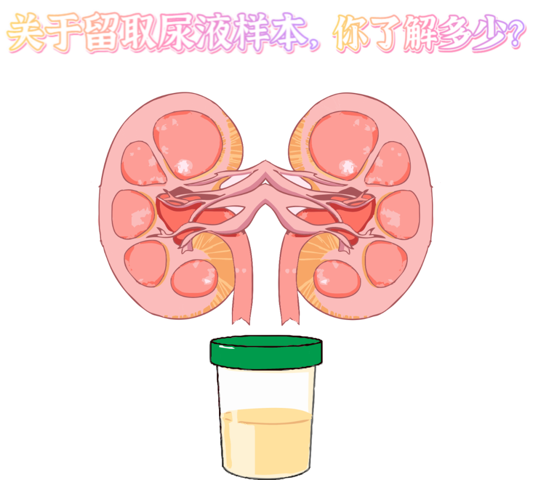 做尿檢，不得不說的注意事項！