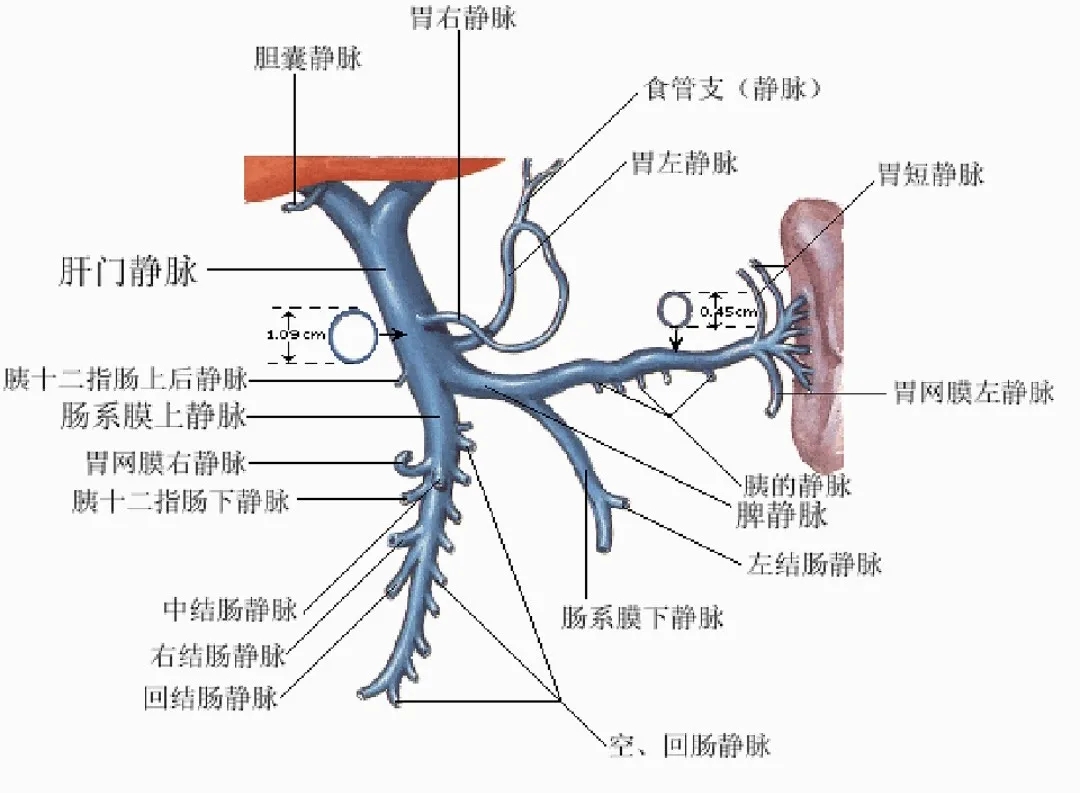 反復(fù)嘔血、黑便怎么辦？TIPS手術(shù)能解決
