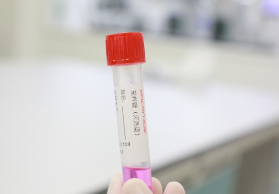 支原體感染檢測(cè)手段知多少？